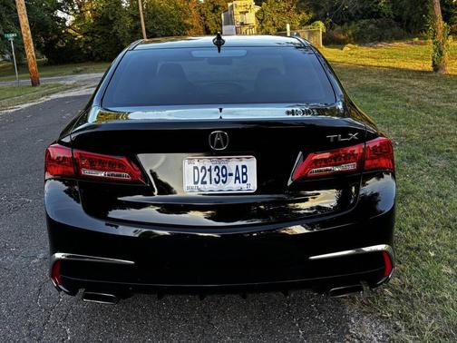 2018 Acura TLX Technology