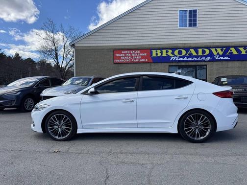 2017 Hyundai ELANTRA Sport
