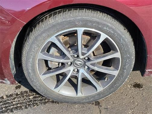 2015 Acura TLX V6 Tech