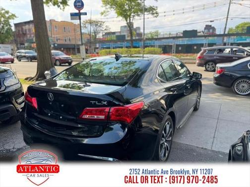 2018 Acura TLX Technology
