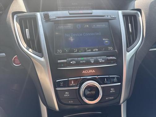 2015 Acura TLX V6 Advance