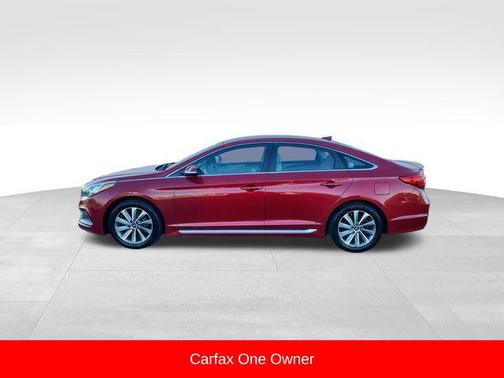 2017 Hyundai SONATA Sport