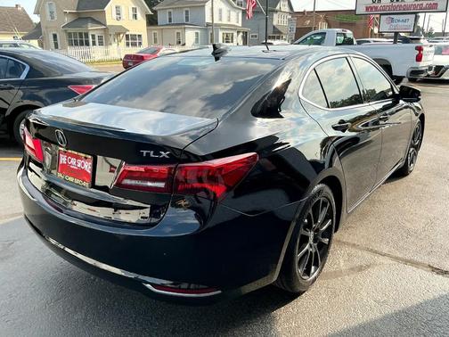 2015 Acura TLX V6 Tech