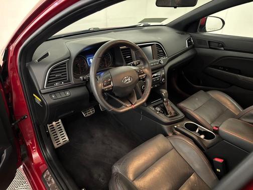 2017 Hyundai ELANTRA Sport
