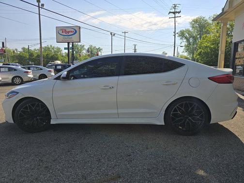 2018 Hyundai ELANTRA Sport