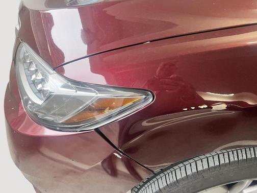 2017 Acura RDX Technology Package