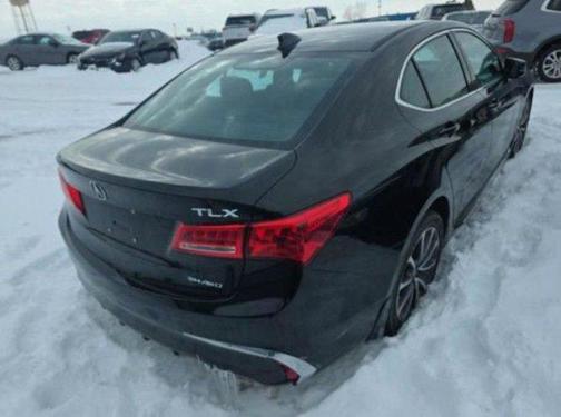 2018 Acura TLX Technology