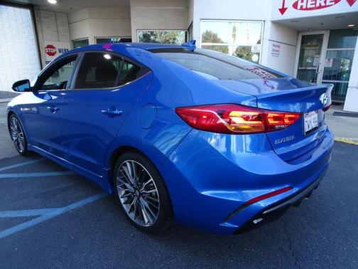 2017 Hyundai ELANTRA Sport