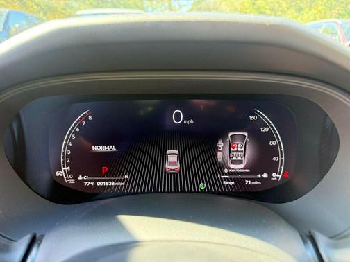 2025 Acura TLX Technology