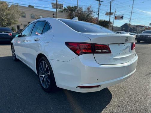 2015 Acura TLX V6 Tech