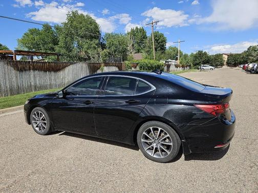 Black 2017 Acura TLX w/Technology Package