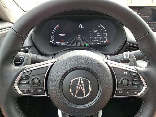 2025 Acura TLX Technology