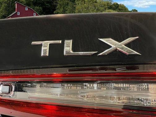 2025 Acura TLX Technology