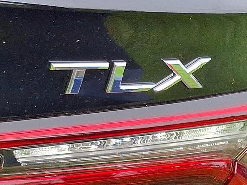 2025 Acura TLX Technology