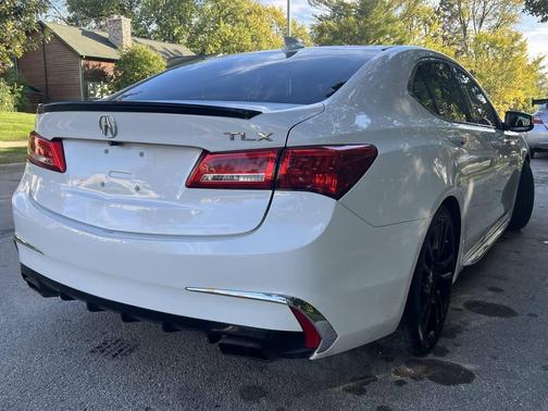 2018 Acura TLX Technology
