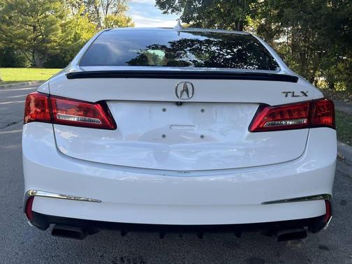 2018 Acura TLX Technology