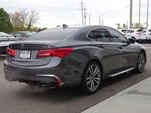 2020 Acura TLX Technology
