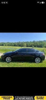Black 2017 Acura ILX 2.4L