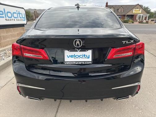 2018 Acura TLX Technology