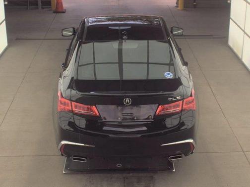 2018 Acura TLX V6 Advance