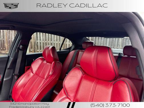 2018 Acura TLX Technology