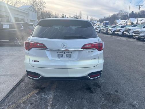 2018 Acura RDX Technology Package