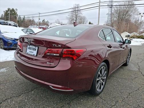 2015 Acura TLX V6 Tech
