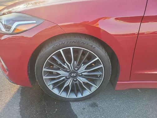 2017 Hyundai ELANTRA Sport