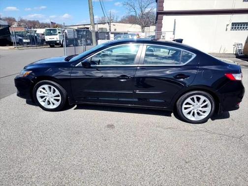 2018 Acura ILX Technology Plus Package