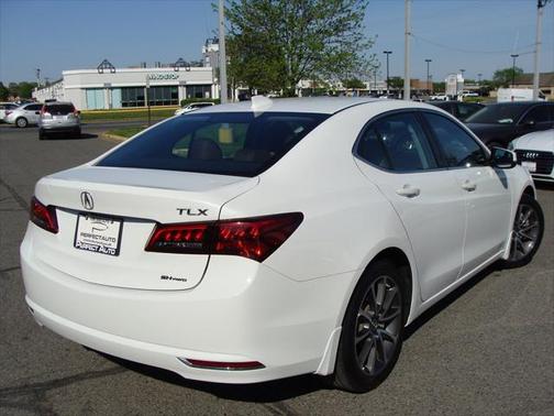 2015 Acura TLX V6 Tech