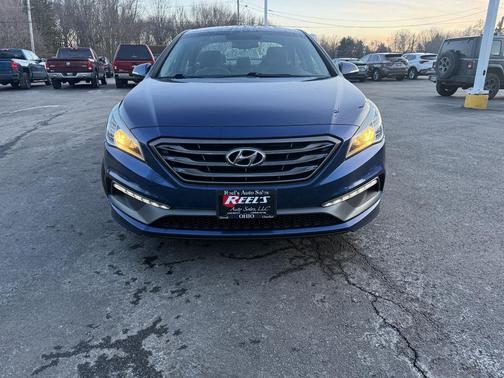2017 Hyundai SONATA Sport