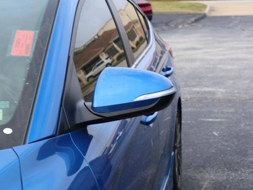 2017 Hyundai ELANTRA Sport