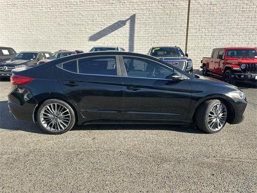 2017 Hyundai ELANTRA Sport