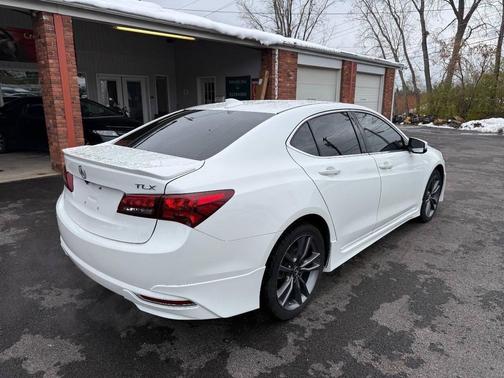 2015 Acura TLX V6 Tech