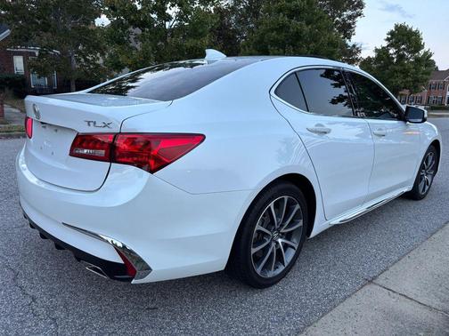 2018 Acura TLX Technology