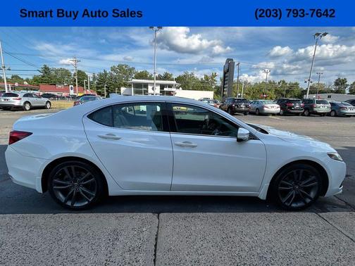 2015 Acura TLX V6 Tech