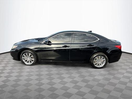 2018 Acura TLX Technology