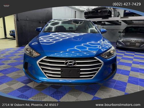 2017 Hyundai ELANTRA SE