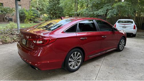 2017 Hyundai SONATA Sport
