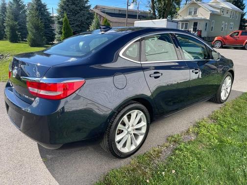 Blue 2016 Buick Verano Convenience Group