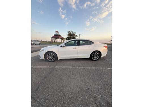 2015 Acura TLX V6 Advance