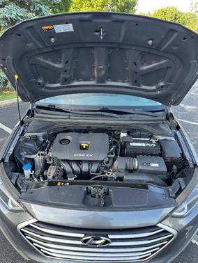 Gray 2018 Hyundai ELANTRA SE