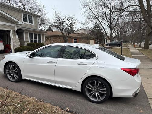 2020 Acura TLX Technology