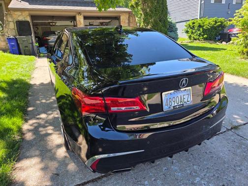 Black 2018 Acura TLX V6 Advance