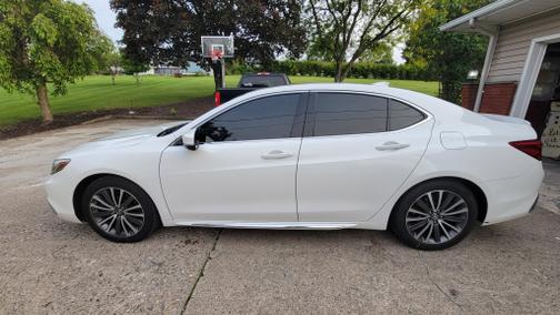 2018 Acura TLX V6 Advance