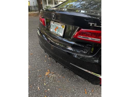 2018 Acura TLX Technology