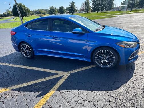 Blue 2018 Hyundai ELANTRA Sport