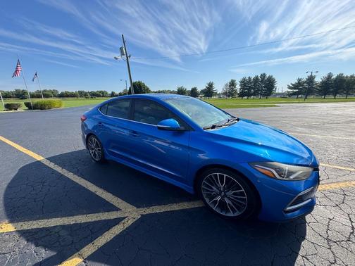 Blue 2018 Hyundai ELANTRA Sport