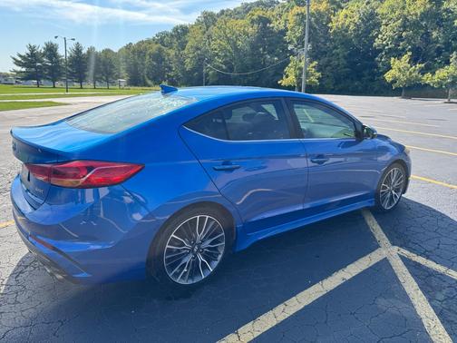 Blue 2018 Hyundai ELANTRA Sport