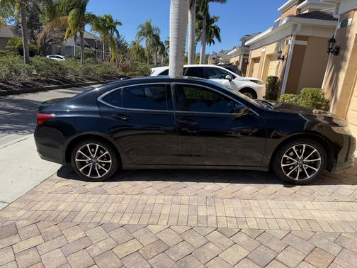 2015 Acura TLX V6 Tech